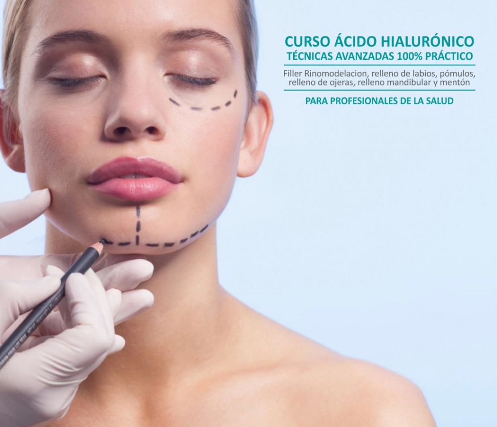 Curso de Ácido Hialurónico Avanzado en ACEE Chile